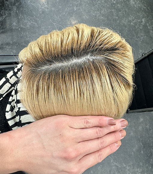 ホワイトベージュBefore画像3